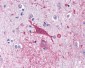 CNR1 / CB1 Antibody (C-Terminus)